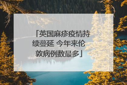 英国麻疹疫情持续蔓延 今年来伦敦病例数最多